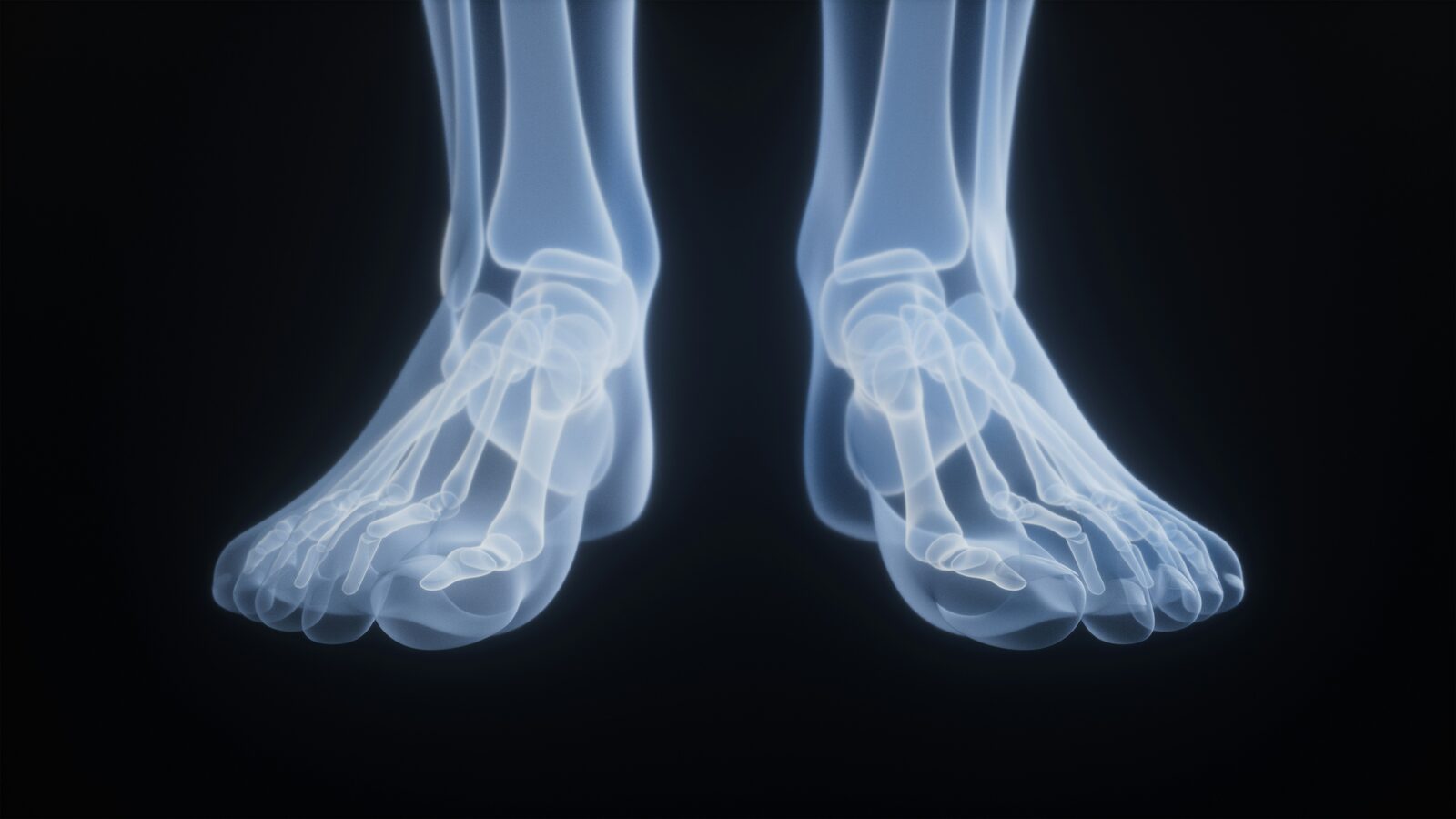 Biomechanical assessment of gait and foot posture at Deal Podiatry in Deal, Kent